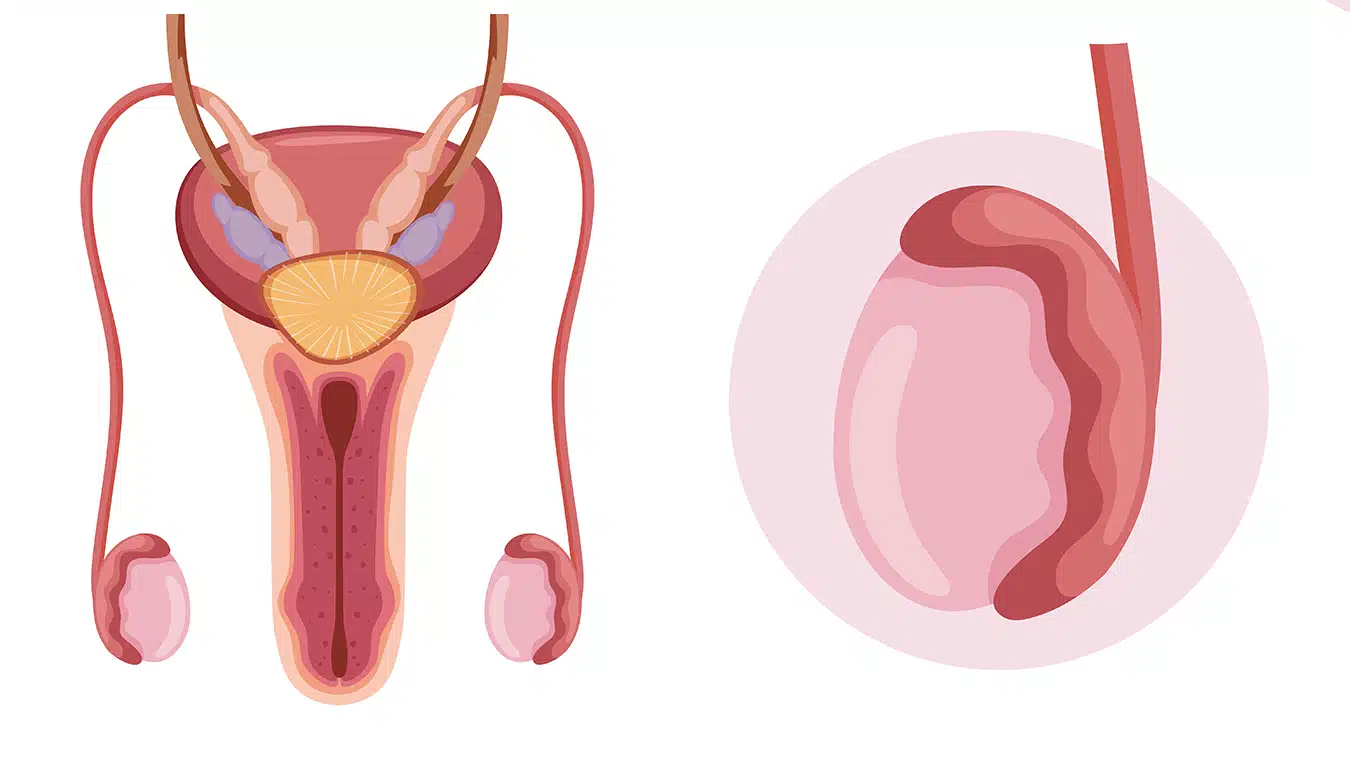 Testis Kanseri Nedir?